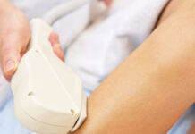 Лазерная эпиляция IPL: этапы и особенности проведения