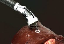 3D-печать внутри тела становится возможной благодаря новому типу гибкой роботизированной руки