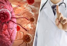 Ученые выяснили, какая диета уменьшает риск развития рака